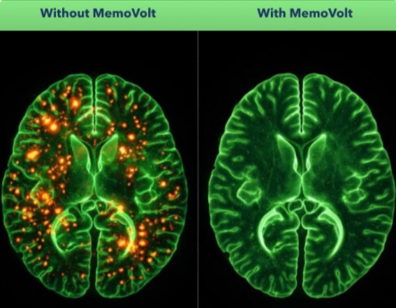 MemoVolt Benefits